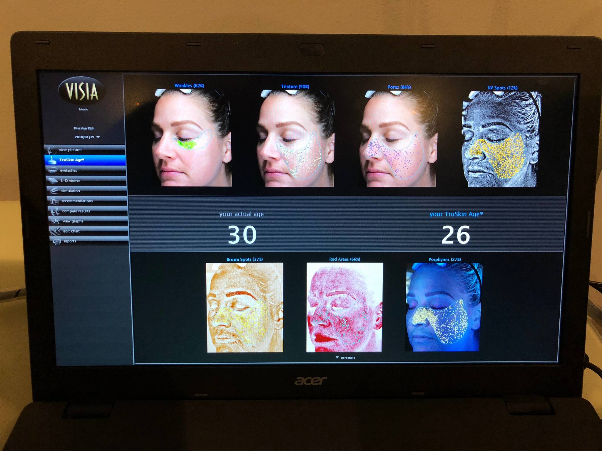 Skin Scan